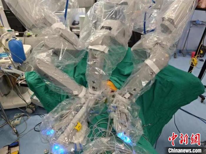 上海专家创新微创手术 借机器人为高龄老人摘除巨大胸腺瘤